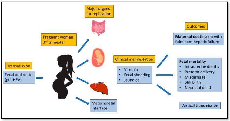 A medical infographic illustrating the transmission, pathogenesis, and clinical outcomes of Hepatitis E virus (HEV), specifically genotype 1 (gt1 HEV), in pregnant women during the third trimester. The diagram shows the transmission occurring via the fecal-oral route. Major organs for viral replication are identified as the intestines, liver, the fetus, and the maternofetal interface. Clinical manifestations listed include viremia, fecal shedding, and jaundice. The right side of the infographic delineates serious maternal and fetal outcomes: maternal death associated with fulminant hepatic failure, and high fetal mortality rates linked to intrauterine deaths, preterm delivery, miscarriage, stillbirth, and neonatal death. The diagram also highlights the risk of vertical transmission from mother to fetus. This educational visual is designed for medical curriculum use, focusing on infectious disease pathology and obstetric complications related to viral hepatitis.