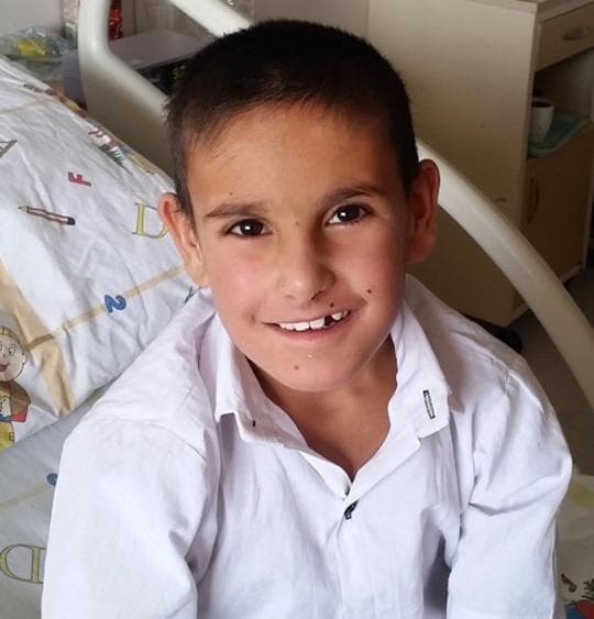 Clinical photograph of a 7-year-old male patient upon discharge from a Pediatric Intensive Care Unit following recovery from severe leptospirosis. The patient is shown in a seated position within a healthcare environment, indicated by a hospital bed with pediatric-themed linens in the background. He is alert and oriented, exhibiting a normal skin tone with mild residual malar flushing. A small benign-appearing nevus is noted adjacent to the left nasal ala. The patient's smile reveals typical mixed dentition for his age group, with a missing primary tooth in the upper right quadrant. No visible signs of the previously reported diffuse erythema or conjunctival suffusion remain. The image serves as a visual documentation of clinical improvement and physiological stability following treatment for multisystem involvement, including acute kidney injury and hemodynamic instability caused by Leptospira infection.