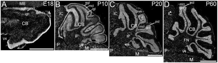 This figure presents a series of sagittal fluorescence microscopy images illustrating the expression of ELOVL4 in the developing cerebellum across four stages: embryonic day 18 (E18), postnatal day 10 (P10), P20, and P60. (A) At E18, ELOVL4 labeling is prominent in the nascent external granule cell layer (egl) and inner granule cell layer (igl) of the developing cerebellum (CB). (B) By P10, intense labeling persists in the egl and igl, with additional expression in cells traversing the molecular cell layer (mcl) and within the deep cerebellar nuclei, such as the interpositus nucleus (IP). (C) At P20, reflecting mature cerebellar layering, labeling is most intense in the granule cell layer (gcl), with moderate labeling in the Purkinje cell layer (pcl) and molecular layer. (D) The P60 stage shows a distribution pattern similar to P20, with continued high-intensity expression in the gcl and deep nuclei, including the fastigial nucleus (FN). These images demonstrate the developmental regulation of ELOVL4, a protein involved in the synthesis of very-long-chain fatty acids, primarily localized within neuronal cell bodies and specific cerebellar cortical layers.