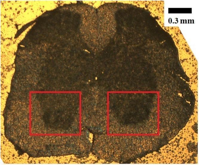 This microphotograph (5X objective) displays a transverse cross-section of a mouse spinal cord at the lumbar level (L1-L2), an important model for studying neurodegenerative conditions like ALS. The section demonstrates the classic internal architecture of the spinal cord, featuring a central butterfly-shaped region of darker gray matter surrounded by peripheral lighter-colored white matter. The image is oriented with the dorsal half at the top and the ventral half at the bottom. Two red boxes highlight the bilateral ventral horns within the gray matter, which are the specific anatomical locations where motor neuron cell bodies reside. The visual distinction between the lipid-rich white matter and the protein-rich gray matter is evident through the variation in tissue density and staining. A scale bar indicating 0.3 mm is provided in the top right corner for morphometric reference. This image serves as a foundational anatomical reference for histological analysis and spectroscopic probing of spinal cord pathology.