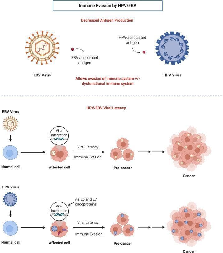 This pathophysiology diagram illustrates the mechanisms of immune evasion and viral carcinogenesis for Epstein-Barr Virus (EBV) and Human Papillomavirus (HPV). The top section compares the structural morphology of the two viruses: EBV is shown as an enveloped spherical virion with radiating surface spikes, while HPV is depicted as a non-enveloped icosahedral-like structure with a uniform, gear-shaped capsid. Both viruses are shown producing minimal antigens to evade host immune detection. The lower section details parallel oncogenic pathways. For both viruses, the process begins with a 'Normal cell' transitioning to an 'Affected cell' through 'Viral integration' of genetic material into the host genome. In HPV, this integration is specifically noted as occurring via E6 and E7 oncoproteins. This leads to 'Viral Latency' and 'Immune Evasion,' resulting in clonal expansion into a 'Pre-cancer' cluster of cells and ultimately progressing to a disorganized, densely packed 'Cancer' cell mass. The diagram highlights the clinical significance of viral latency and reduced antigen expression as key factors in the development of virus-associated malignancies like oropharyngeal and nasopharyngeal carcinomas.