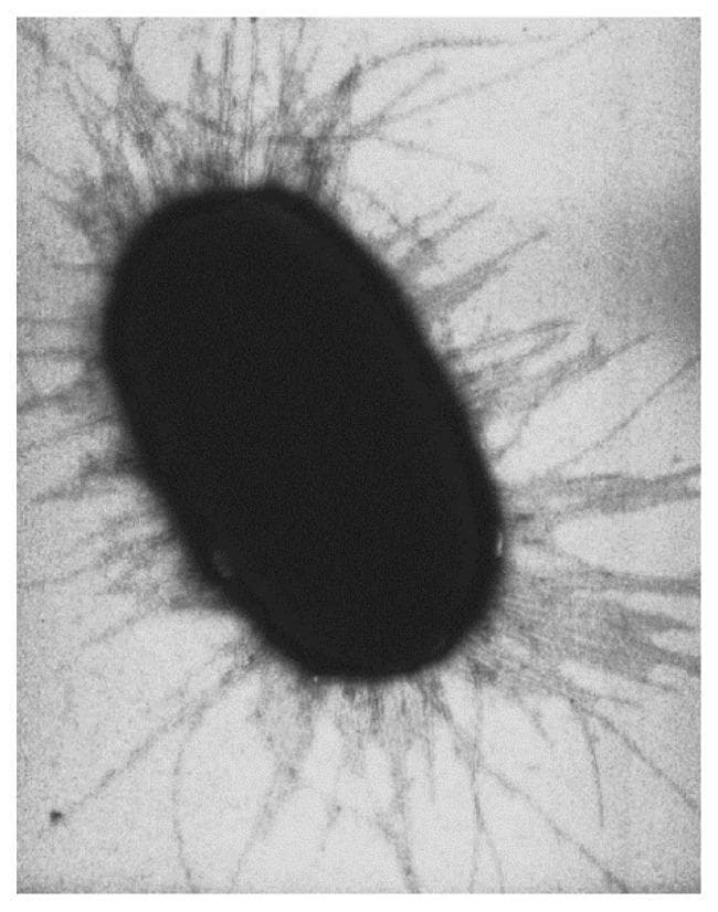 This diagnostic image is a high-magnification electron micrograph illustrating the microbiology and pathophysiology of an Escherichia coli (E. coli) bacterium. The central structure is a dark, electron-dense, capsule-shaped (bacillus) body with a smooth surface texture. Radiating outward from the entire periphery of the bacterial cell wall are numerous fimbriae (also known as common pili). These fimbriae appear as thin, flexible, filamentous appendages with a uniform, dense distribution, giving the organism a characteristic fuzzy or corona-like appearance. Clinically, these organelles are significant as they consist of pilin subunits and terminal adhesins, which facilitate bacterial adhesion to host carbohydrate receptors, a critical step in establishing infections such as urinary tract infections or gastroenteritis. The image serves as a primary educational resource for understanding bacterial morphology, virulence factors, and the mechanical basis of microbial attachment in clinical infectious diseases.