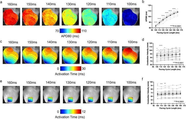 This composite educational image illustrates the restitution dynamics of the heart using optical mapping in a guinea pig model. The content is divided into six panels (a-f) focusing on electrophysiological parameters.
Panel (a) presents high-resolution false-color maps showing the action potential duration at 80% repolarization (APD80). As the pacing cycle length (PCL) decreases from 160ms to 100ms, a visible transition from red (longer APD80, ~110ms) to blue (shorter APD80, ~70ms) occurs, a trend quantified in the corresponding line graph (b).
Panels (c) and (e) display activation maps where color and isochronal lines represent electrical impulse travel time. Panel (c) shows whole-heart activation, while (e) restricts the analysis to a specific apical region. These maps demonstrate changes in activation patterns and timing as PCL shortens. Panels (d) and (f) provide statistical grouped data for conduction velocity (CV) as a function of PCL, showing a significant decrease in CV with shorter cycle lengths. This figure is critical for understanding cardiac electrophysiology, rate-dependent remodeling, and arrhythmogenesis markers like APD restitution and conduction slowing.