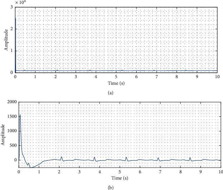 This Comparison Chart displays two waveform plots representing signal processing of an electrocardiogram (ECG) for cardiac arrhythmia diagnosis. Figure (a) illustrates the 'Raw signal' on a 10-second time axis with a high-amplitude y-axis scaled to 10^4. The raw data shows a significant initial artifact/spike reaching 3 x 10^4, which compresses the physiological cardiac waveforms. Figure (b) illustrates the 'Filtered signal' after noise reduction and intermediate filtration. The y-axis in the filtered view is adjusted to a range of -200 to 2000, allowing for the clear visualization of repetitive physiological ECG complexes that were previously obscured. Key educational concepts include signal-to-noise ratio improvement and the application of digital filters to physiological data for better clinical interpretation. This graphic is relevant for medical students and researchers studying diagnostic cardiology, signal processing in medicine, and automated arrhythmia detection systems.