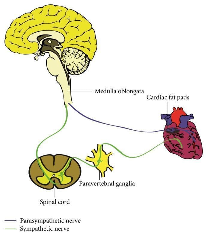 This medical anatomical diagram illustrates the autonomic innervation of the human heart, detailing both the parasympathetic and sympathetic pathways. The parasympathetic pathway is represented by a purple line originating from the medulla oblongata within the brainstem; these preganglionic fibers travel via the vagus nerve to synapse at the cardiac fat pads (ganglionated plexi) located on the epicardial surface. The sympathetic pathway is depicted in green, showing the circuit from the spinal cord to the paravertebral ganglia. From these ganglia, postganglionic sympathetic fibers project to the base of the heart and distribute into the myocardium. Key anatomical structures labeled include the medulla oblongata, cardiac fat pads, spinal cord, and paravertebral ganglia. The diagram serves as an educational tool for understanding the neural regulation of cardiac performance, specifically the origin and trajectory of autonomic fibers that modulate heart rate and contractility.