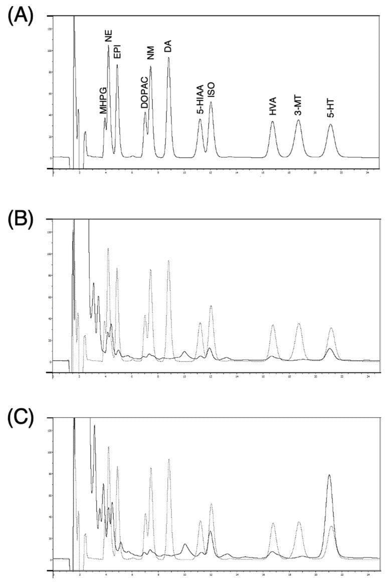 The image displays three representative high-performance liquid chromatography (HPLC) chromatograms (labeled A, B, and C) used to measure monoamine neurotransmitters and their metabolites. Panel A shows a standard solution with clearly resolved and labeled peaks for MHPG, Norepinephrine (NE), Epinephrine (EPI), DOPAC, Normetanephrine (NM), Dopamine (DA), 5-HIAA, Isoprenaline (ISO), HVA, 3-MT, and Serotonin (5-HT). Panels B and C illustrate microdialysis samples obtained from a biological model. Panel B represents the baseline (pre-treatment) sample, showing significantly lower peak amplitudes for most monoamines compared to the standard. Panel C demonstrates the neurochemical profile after the infusion of 1 mM imipramine, a tricyclic antidepressant. Visually, Panel C shows a marked increase in the peak height and area for Serotonin (5-HT) and Norepinephrine (NE) relative to Panel B, reflecting the drug's mechanism as a reuptake inhibitor. This comparison serves as an educational tool for analytical chemistry and pharmacology, demonstrating how microdialysis and HPLC are used to monitor real-time changes in interstitial neurotransmitter concentrations following pharmacological intervention.