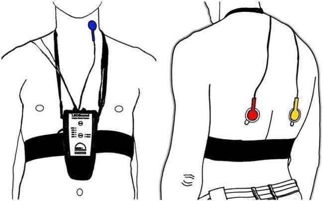 An anatomical diagram illustrating the placement of the LEOSound lung-sound monitor and its bio-acoustical sensors on a patient. The illustration includes two views: an anterior (front) view and a posterior (back) view. In the anterior view, a recording device is secured to the mid-thorax by a black chest belt and a neck strap. A blue tracheal microphone is positioned on the neck near the trachea. In the posterior view, two additional microphones are attached using adhesive pads to the inferior region of the left (red microphone) and right (yellow microphone) scapula. The system is designed for mobile, long-term recording and automated analysis of respiratory sounds such as coughing and wheezing. The diagrams emphasize the standardized anatomical landmarks required for optimal auscultation and data collection in clinical or home settings.
