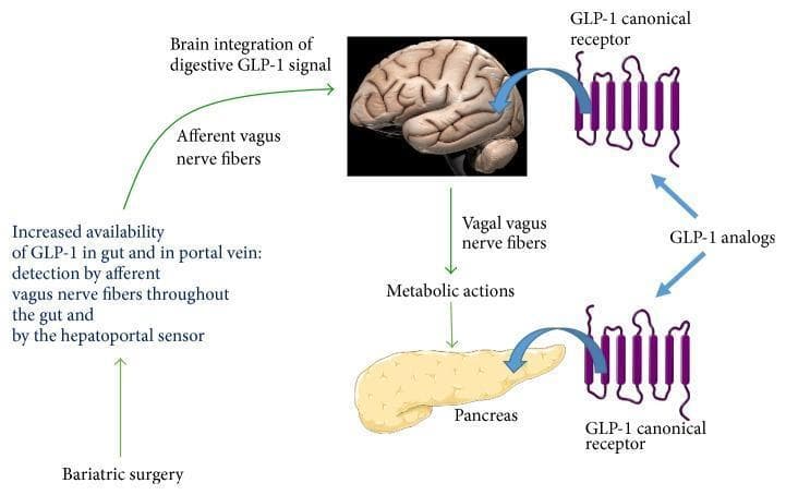 This pathophysiology diagram illustrates the comparative mechanisms of GLP-1 (glucagon-like peptide-1) action following bariatric surgery versus the administration of GLP-1 analogs. The bariatric surgery pathway is depicted as a gut-brain-periphery axis: surgery increases GLP-1 availability in the gut and portal vein, which is detected by hepatoportal sensors and afferent vagus nerve fibers. This signal travels to the brain for integration, which then sends efferent signals via vagal nerve fibers to trigger metabolic actions in peripheral organs like the pancreas. In contrast, the diagram shows GLP-1 analogs bypassing the gut-brain circuit to act directly on GLP-1 canonical receptors (represented by 7-transmembrane G protein-coupled receptor icons) located in tissues such as the brain and pancreas. Key anatomical landmarks included are the brain and the pancreas. This visual serves as an educational tool for endocrinology and metabolic surgery, highlighting the neuro-hormonal integration involved in endogenous GLP-1 signaling compared to direct pharmacological receptor activation.