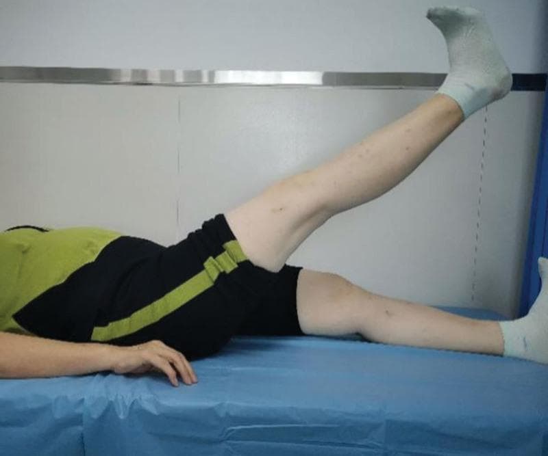 A clinical photograph illustrating a straight leg raise (SLR) exercise for quadriceps strengthening, commonly prescribed for knee osteoarthritis (KOA) rehabilitation. The patient is shown in a supine position on a medical examination table. The 'affected' leg is elevated to an angle of approximately 30 to 45 degrees, maintaining full knee extension (0°). The ankle is held in a neutral position with the heel positioned approximately 25 to 30 cm above the surface of the bed. The contralateral leg remains resting on the table for stability. This procedural image demonstrates a non-weight-bearing isometric and isotonic exercise designed to improve muscle recruitment and joint stability. The visual is intended for orthopedic and physical therapy education, focusing on conservative management strategies for knee joint health and post-treatment recovery.