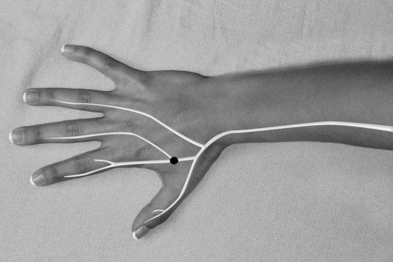 This clinical photograph/anatomical diagram hybrid depicts the dorsal aspect of a human hand and distal forearm in a grayscale format. Superimposed on the anatomy is a schematic representation of the superficial branch of the radial nerve. A thick white line originates from the radial side of the forearm, traveling distally across the wrist. Upon reaching the dorsum of the hand, the line branches into multiple digital nerves that extend toward the thumb, index, middle, and ring fingers. A prominent black circular marker is placed on the first dorsal interosseous space (the web space between the thumb and index finger), identifying the Superficial Radial Neuropuncture Point (SRNP). The image illustrates the neuroanatomical basis for specific acupuncture or electroacupuncture sites, emphasizing the relationship between traditional medicine points and peripheral nerve distribution. This visual is intended for healthcare professionals or students studying neuroanatomy, physical medicine, or integrative pain management protocols.
