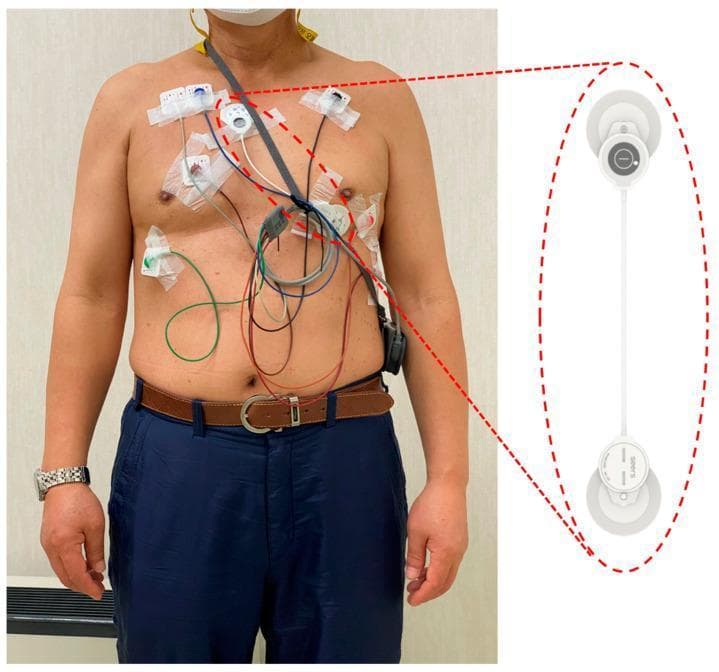 A clinical photograph and product detail illustrating a comparative setup for cardiac monitoring. The left panel shows a male participant wearing two types of Electrocardiogram (ECG) monitoring systems simultaneously on the precordium: a traditional 3-lead Holter monitor and an adhesive patch-type single-lead ECG device (mobiCARE-MC100). The Holter system consists of multiple adhesive electrodes connected via color-coded wires (red, green, blue, white, black) to a handheld recording unit worn at the waist. In contrast, the single-lead patch device is a compact, wireless system consisting of two circular adhesive electrodes connected by a thin, 120mm flexible white strip, placed diagonally across the chest to record lead II signals. The right panel provides a magnified view of the mobiCARE-MC100 device, highlighting its minimalist, patch-based design. This visual comparison demonstrates the difference in patient burden between conventional wired Holter monitoring and modern wearable adhesive patches used for long-term arrhythmia detection and heart rate variability analysis.