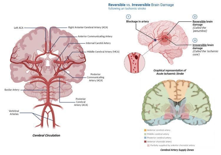 Educational medical infographic containing three panels illustrating cerebral neurovasculature and acute ischemic stroke pathophysiology. The first panel, 'Cerebral Circulation', features a detailed anatomical diagram of the Circle of Willis, labeling the vertebral arteries, basilar artery, and its bifurcation into the posterior cerebral arteries (PCA). It further illustrates the internal carotid arteries, middle cerebral arteries (MCA), and the anterior cerebral arteries (ACA) connected by the anterior communicating artery. The second panel, 'Graphical representation of Acute Ischaemic Stroke', depicts a sagittal view of the brain showing an arterial blockage. It differentiates between the 'ischemic core' (irreversible damage) and the surrounding 'penumbra' (reversible/salvageable tissue). The third panel, 'Cerebral Artery Supply Zones', is a coronal brain cross-section color-coded to show perfusion territories, specifically highlighting regions supplied by the ACA (orange), MCA (green), PCA (blue), and anterior choroidal artery (red). This resource is designed for students learning about stroke mechanisms, vascular anatomy, and clinical neuro-perfusion.