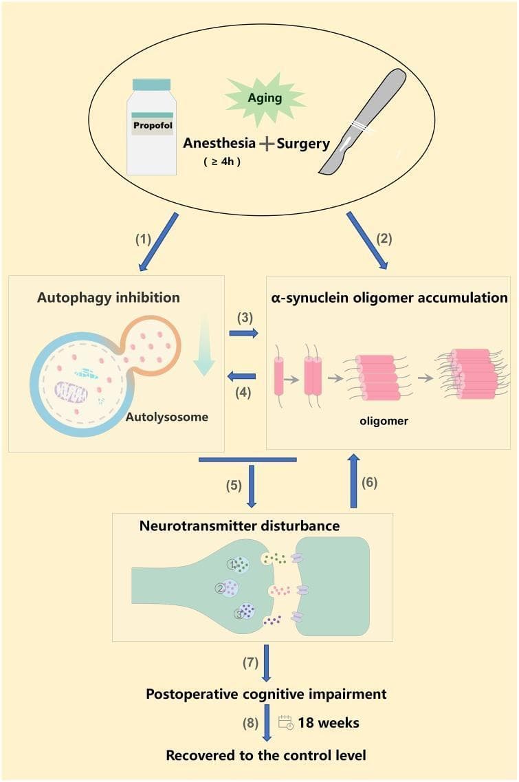 This pathophysiology diagram illustrates a proposed mechanism for Postoperative Cognitive Impairment (POCD) in the context of aging. The entry point shows a combination of long-term propofol anesthesia (≥ 4h) and surgery acting as triggers. The pathway branches into two concurrent pathological processes: (1) Autophagy inhibition, visualized by an inhibited autolysosome structure, and (2) α-synuclein oligomer accumulation. These two processes exhibit a positive feedback loop (steps 3 and 4), where autophagy failure promotes oligomerization and vice versa. These hippocampal cellular dysfunctions lead to (5) Neurotransmitter disturbance, depicted at a synaptic cleft with imbalances in (1) Norepinephrine, (2) Dopamine, and (3) 5-hydroxytryptamine (serotonin). This synaptic instability further exacerbates α-synuclein aggregation (6), ultimately resulting in (7) Postoperative cognitive impairment. A final timeline (8) indicates a progression toward recovery at 18 weeks post-intervention. The diagram serves as an educational tool for understanding neurodegenerative-like mechanisms in geriatric anesthesia and perioperative medicine.