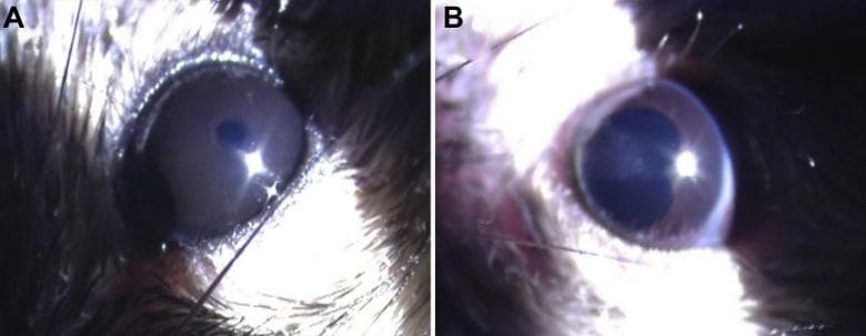 This clinical photograph displays a comparative analysis of the anterior segment of the eye in a medical research model. Image A depicts a healthy eye with a clear anterior chamber and a regular, circular pupil, showing no signs of inflammation. Image B demonstrates pathological changes consistent with Acute Anterior Uveitis (AAU). Key features in image B include an irregular, kidney-shaped pupil following the administration of mydriatic agents. The presence of posterior synechia—adhesions between the iris and the lens—is evident, which prevents uniform pupillary dilation. This side-by-side comparison illustrates the visual hallmarks of an ocular inflammatory response and its effect on pupillary morphology and function. The imagery is essential for studying inflammatory pathways, particularly those involving Toll-like receptor (TLR4) or lipopolysaccharide (LPS)-induced endotoxin uveitis models. Educational concepts include ocular pathology, iris-lens adhesions, and the clinical manifestations of anterior segment inflammation.