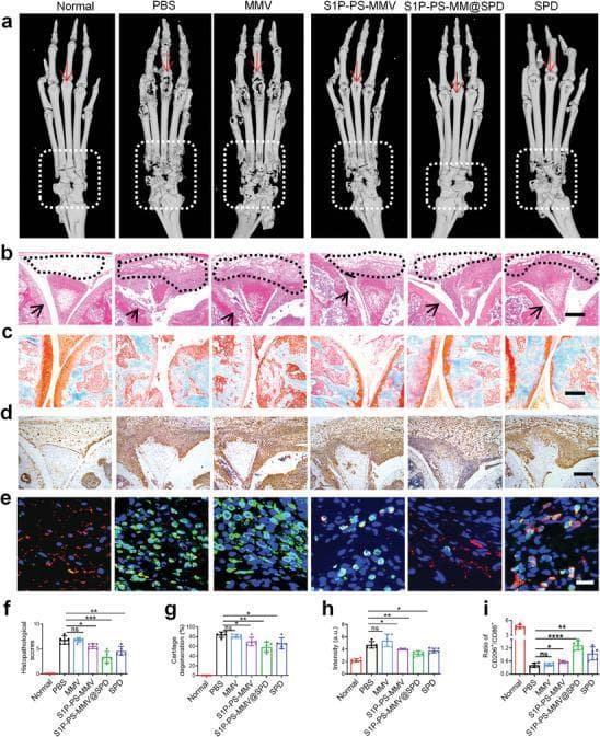 This composite educational image illustrates the therapeutic effects of various treatments on joint pathology in a mouse model of rheumatoid arthritis (RA). Row A presents Micro-CT reconstructions of mouse paws; the PBS and MMV groups show severe bone erosion and joint space narrowing in the phalanges (arrows) and tarsal bones (dashed boxes), while the S1P-PS-MMV@SPD group demonstrates significantly preserved bone architecture. Rows B through D show histological sections of joint tissue: H&E staining (B) highlights synovial hyperplasia (triangles) and pannus formation; Safranin-O/Fast Green staining (C) evaluates cartilage proteoglycan content (red staining), showing severe loss in PBS/MMV groups compared to the treatment groups; and immunohistochemistry (D) displays TNF-α expression (brown staining) as a marker of inflammation. Row E features immunofluorescence staining for macrophage polarization, using CD86 (green, M1) and CD206 (red, M2) markers. Panels F through I provide quantitative analysis for histopathological scores, cartilage degeneration, TNF-α intensity, and M2/M1 macrophage ratios, collectively demonstrating that S1P-PS-MMV@SPD reduces inflammation and promotes tissue repair in arthritic joints.
