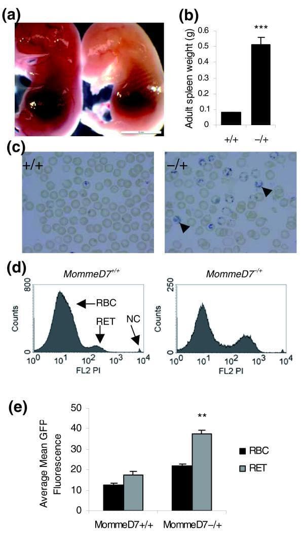 This composite educational graphic illustrates hematopoietic abnormalities in MommeD7 mutant mice across multiple modalities. Panel (a) contains clinical photographs of 17.5 dpc embryos, comparing a phenotypically normal (red/vascularized) embryo with an abnormal, pale embryo suggestive of severe anemia or a red cell defect. Panel (b) is a bar graph showing significant splenomegaly in adult heterozygous (-/+) mice compared to wild-type (+/+). Panel (c) presents light microscopy of peripheral blood smears; the mutant smear (-/+) displays a high frequency of reticulocytes—identified by characteristic punctate blue staining (arrowheads)—indicating a compensatory response to anemia. Panel (d) shows flow cytometry histograms of propidium iodide fluorescence, quantifying the shift from mature red blood cells (RBC) to an increased reticulocyte (RET) population in the mutant. Panel (e) uses a bar chart to compare average mean GFP fluorescence, demonstrating higher expression levels in reticulocytes versus RBCs, particularly in the heterozygous line. Collectively, these images illustrate the pathophysiology of a hematopoietic mutation leading to embryonic pallor, adult splenomegaly, and increased reticulocytosis.