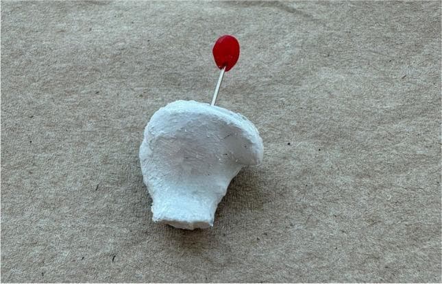 This clinical photograph shows a custom-molded therapeutic earplug designed for the treatment of temporomandibular joint (TMJ) disorders. The specimen is fabricated from a white, opaque, rigid material (Fotoplast) with a granular, unpolished surface texture that reflects the unique anatomy of an individual's external auditory canal. A key feature is the inclusion of a thin silver-colored metal handle protruding from the body of the plug, capped with a bright red spherical marker. This marker serves a dual purpose: facilitating easy insertion and removal by the patient and acting as a lateralization indicator (red for the right ear). The plug is designed to sit flush with the outer edge of the ear canal and features a longitudinal perforation (not directly visible from this angle) to prevent hearing impairment. This device illustrates a near-field therapeutic approach to managing myogenous TMD and bruxism by stabilizing the joint space through the ear canal.
