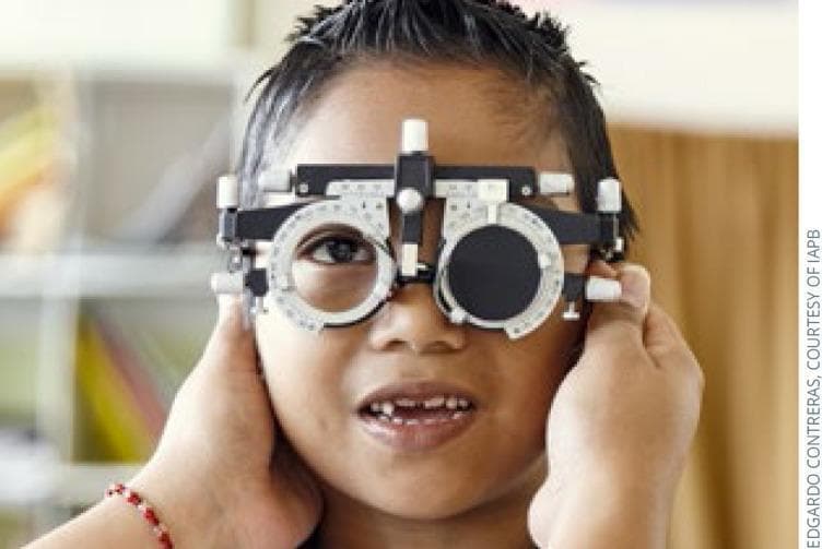 A clinical photograph of a pediatric patient undergoing a refraction examination using an ophthalmic trial frame. The image illustrates a young child with dark hair and visible primary dentition gaps, wearing a standard black and white adjustable trial frame. The frame features multiple adjustment knobs for interpupillary distance and temple length. In the current setup, the patient's right eye is visible through an empty lens holder, while the left eye is covered by a solid black occluder lens, a common configuration used to measure monocular visual acuity or perform subjective refraction. The child is holding the frame's temples with both hands to ensure stability during the assessment. This visual demonstrates common optometric equipment used for diagnosing refractive errors like myopia, hyperopia, and astigmatism in a clinical setting.