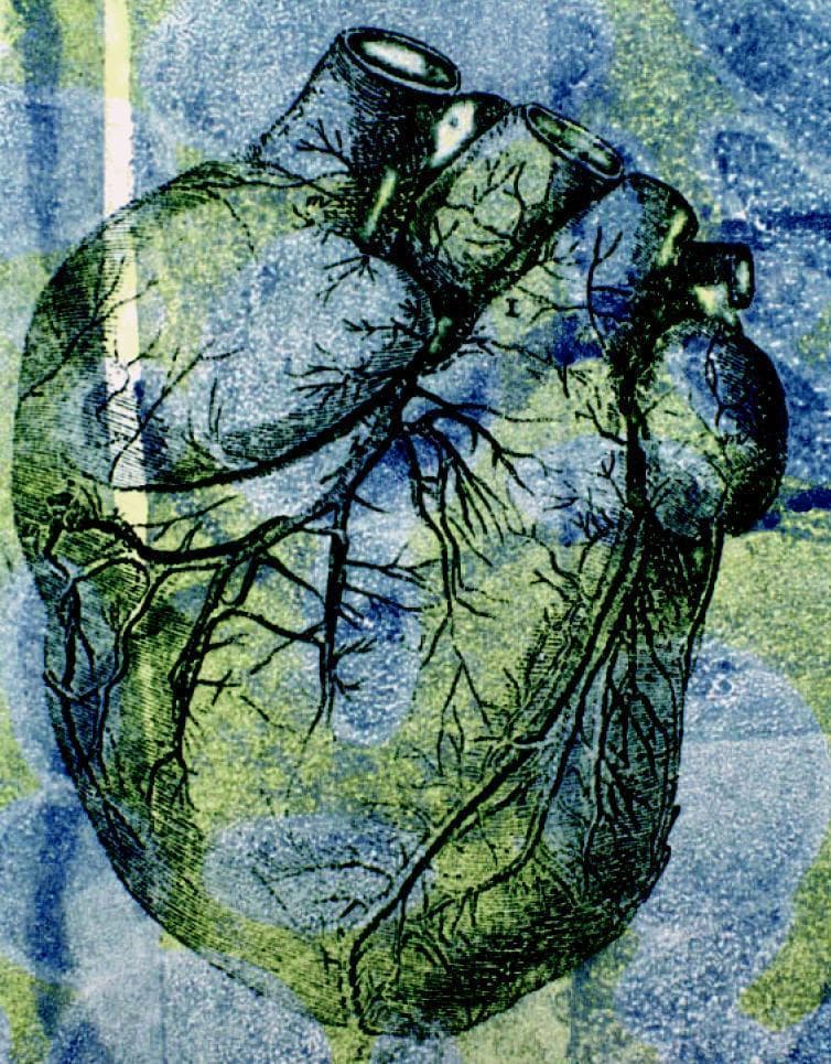 This stylized anatomical illustration depicts a human heart in an anterior view, emphasizing its gross external morphology and coronary vasculature. The organ exhibits its characteristic ovoid shape with superiorly positioned great vessels, including cross-sectional views of the aorta and pulmonary trunk. The surface anatomy highlights the intricate branching patterns of the coronary arteries and veins, demonstrating their distribution across the myocardium toward the apex. The image uses an artistic, high-contrast color palette of green, blue, and yellow to delineate anatomical boundaries and the etched texture of the cardiac tissue. Educationally, the diagram serves to illustrate the relationship between the major cardiac chambers and the superficial vascular network, particularly in the context of cardiovascular health and hemodynamic pressures. The visualization emphasizes the complexity of the organ's blood supply, which is critical for understanding conditions like hypertension and coronary artery disease.