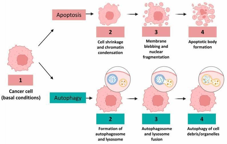 A comparative pathophysiology diagram illustrating the morphological evolution of a human cancer cell undergoing two distinct pathways of programmed cell death: apoptosis and autophagy. The diagram originates from a central 'Cancer cell (basal conditions)' (labeled 1). The top pathway, Apoptosis, follows three subsequent stages: (2) cell shrinkage and chromatin condensation where the nucleus becomes dense; (3) membrane blebbing and nuclear fragmentation where the cytoplasm and nucleus begin to break apart; and (4) apoptotic body formation, resulting in discrete membrane-bound vesicles. The bottom pathway, Autophagy, proceeds through: (2) formation of an autophagosome and lysosome, depicted in a circular inset; (3) autophagosome and lysosome fusion, showing the two vesicles merging; and (4) autophagy of cell debris/organelles within a mature autolysosome. This anatomical illustration serves as a pedagogical tool for distinguishing between the nuclear fragmentation of apoptosis and the vacuolar degradation characteristic of autophagy in oncology and cellular biology.