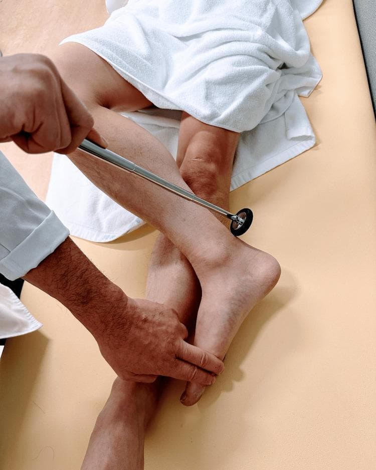 A clinical photograph demonstrating the procedural technique for eliciting the Achilles tendon reflex (ankle jerk) with the patient in a supine position using the 'figure four' modification. The patient is lying supine with the tested leg flexed at the knee and the lateral malleolus resting on the contralateral shin. An examiner’s hand is seen applying gentle passive dorsiflexion to the foot to put the Achilles tendon under tension. Simultaneously, a neurological reflex hammer with a metallic handle and a rubber head is positioned to strike the tendon. This maneuver targets the S1 and S2 nerve roots and the tibial nerve, evaluating the integrity of the lower motor neuron reflex arc. The image illustrates proper limb positioning, tendon stretching, and tool orientation for physical examination training in neurology and primary care.