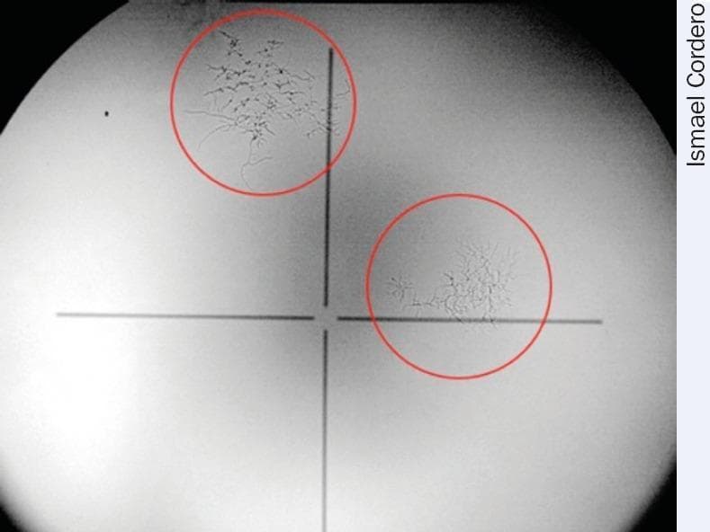 This diagnostic image demonstrates the presence of fungal growth on an ophthalmic optical lens, likely from a slit lamp or similar diagnostic equipment. The image shows a gray-scale field of view with a central black crosshair. Two specific areas of interest are highlighted with red circles. The upper-left circle contains a larger, dense network of dark, branching, web-like hyphae. These fungal structures radiate from a central core, becoming more diffuse at the periphery. The lower-right circle shows a smaller, less dense fungal colony with a similar dendritic or mycelial pattern. In a clinical ophthalmology context, this illustrates environmental contamination of diagnostic equipment, which can lead to light scattering, decreased image contrast, and eventual permanent etching of lens coatings if not mitigated via proper storage and humidity control.