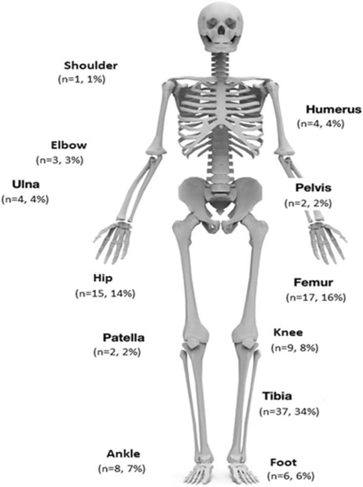 This infographic presents an anatomical diagram of the human skeleton used as a data visualization tool to map the distribution of orthopedic infections across various skeletal sites. The diagram provides quantitative data for 107 cases, labeling specific bones and joints with the number of patients (n) and the corresponding percentage of the total study population. Labeled anatomical regions include the upper extremity (shoulder, humerus, elbow, and ulna), the axial/pelvic region (pelvis), and the lower extremity (hip, femur, knee, patella, tibia, ankle, and foot). The visualization highlights the tibia as the most frequent site of infection (n=37, 34%), followed by the femur (n=17, 16%) and hip (n=15, 14%). This clinical illustration is designed for orthopedic and infectious disease education, effectively demonstrating the anatomical prevalence of conditions such as fracture-related infection (FRI), chronic osteomyelitis (COM), and prosthetic joint infection (PJI) within a clinical cohort.