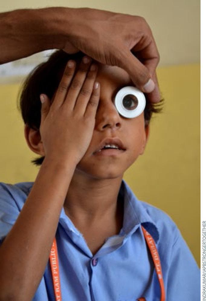 This clinical photograph depicts a pediatric vision screening or eye examination being conducted on a school-aged child in a community setting. The image demonstrates a monocular visual acuity test procedure. The child is manually occluding his right eye with his palm, while an examiner uses an ophthalmic tool, likely a pinhole occluder or a specialized viewing aperture, over the left eye. The examiner’s hand is visible, stabilizing the tool and lifting the child's eyelid to ensure an unobstructed view of the ocular surface and pupil. This visual highlights public health efforts for early detection of refractive errors, such as myopia, in school-aged populations. The setting appears to be a school, indicated by the child's uniform and lanyard. Key educational concepts illustrated include clinical examination techniques for pediatric ophthalmology, the use of simple diagnostic occluders, and vision screening protocols for refractive error identification in low-resource environments.