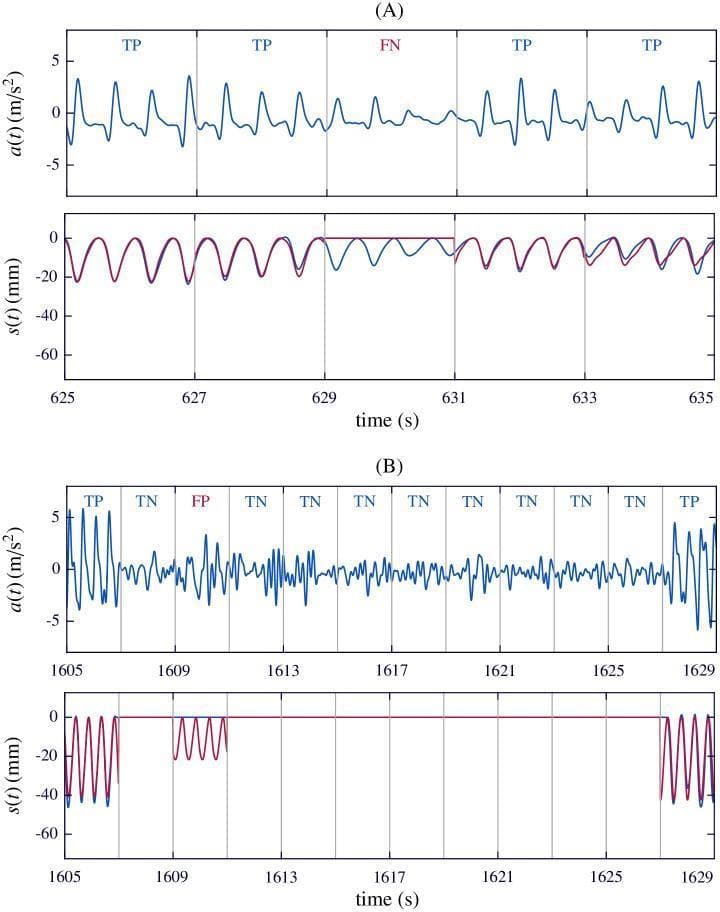 Comparison of chest compression acceleration and displacement signals used in cardiopulmonary resuscitation (CPR) feedback algorithms. Panel A displays a time-series plot of acceleration a(t) in m/s² and compression depth s(t) in mm. It illustrates an 'isolated false negative' (FN) where low-amplitude acceleration and shallow compression depth (approximately 10 mm) lead the algorithm to reconstruct a flat line (red) instead of tracking the actual sinusoidal displacement (blue). Panel B illustrates an 'isolated false positive' (FP), where noisy acceleration signals during a 'hands-off' interval (no compressions) are incorrectly interpreted by the algorithm as compression activity, shown by the red reconstructed signal. The graphs utilize segments labeled TP (True Positive), TN (True Negative), FP, and FN to evaluate algorithm performance. These diagnostic signals are critical for real-time monitoring of CPR quality, ensuring adherence to guidelines for compression rate and depth to optimize hemodynamics during cardiac arrest management.