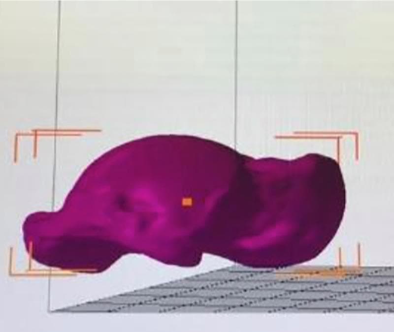 A 3D digital reconstruction of a human talus bone, generated using a laser scanner (HandySCAN 700) and analyzed within Autodesk Netfabb software. The image shows the bone specimen rendered in a solid magenta/purple color, highlighting its complex anatomical contours including the trochlea, neck, and head. The digital model is positioned on a virtual grey grid plane for spatial orientation. Orange bounding box markers and a central anchor point are visible, indicating the software's process for measuring morphometric parameters such as surface area and volume. This visualization is used in orthopedic research to compare anatomical variances and geometric profiles between matched pairs of human cadaveric ankles. The smooth rendering and artificial coloration are typical for CAD-based volumetric and surface analysis in clinical anatomy and podiatric research.