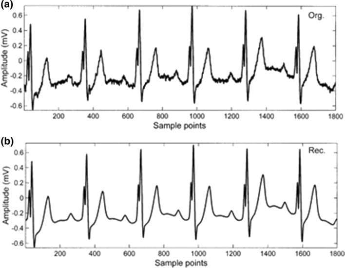 This diagnostic image presents a comparative analysis of electrocardiogram (ECG) signal processing. Panel (a) displays the original raw ECG trace, characterized by visible baseline wander, high-frequency noise, and slight morphological irregularities in the PQRST complexes over 1800 sample points. The amplitude ranges approximately from -0.6 mV to 0.7 mV. Panel (b) shows the reconstructed signal following the application of a Singular Value Decomposition (SVD) algorithm. In the reconstructed trace, there is a significant reduction in noise, resulting in a smoothed baseline and more uniform wave morphologies. The primary physiological features, including the P-waves, QRS complexes, and T-waves, are preserved, though minor notching and high-frequency fluctuations from the original signal are filtered out. This comparison demonstrates the efficacy of SVD in biomedical signal denoising and feature extraction while maintaining the essential diagnostic intervals and amplitudes required for cardiac rhythm analysis.