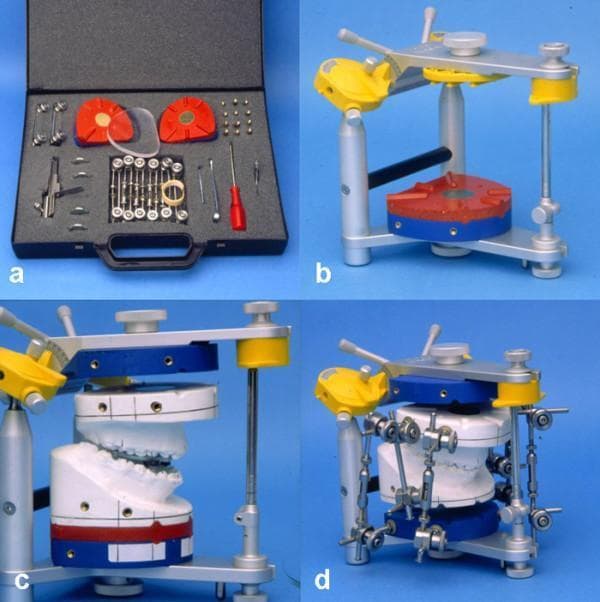 A series of four clinical photographs illustrating the Calibrated Double Splint - Münster Model Surgery System (KD-MMS), a specialized orthognathic surgical planning tool. Frame (a) shows the hardware kit, including red and clear split plates, precision screws, and specialized screwdrivers. Frame (b) depicts a SAM-P articulator with integrated red and blue double split plates mounted on the lower member, serving as a standardized reference base. Frame (c) shows white plaster dental casts mounted within the articulator; the setup is oriented parallel to the Axis Orbital Plane to facilitate precise simulation of maxillary displacement. Frame (d) demonstrates the final pre-surgical configuration, where the repositioned dental models are stabilized using a system of adjustable metal rods and screws. This device allows for the translation of two-dimensional cephalometric prediction planning into a three-dimensional model surgery environment for the treatment of dentofacial deformities and malocclusions.