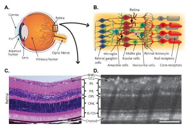 This composite educational illustration presents the multi-layered anatomy of the retina through schematic diagrams and comparative diagnostic imaging. Panel A shows a sagittal anatomical diagram of the eye, highlighting key structures including the cornea, iris, lens, vitreous humor, and optic nerve. Panel B provides a high-magnification schematic of the retinal cellular architecture, illustrating the relationship between photoreceptors (rods and cones), bipolar cells, horizontal cells, amacrine cells, Müller glia, and retinal ganglion cells (RGCs). Panels C and D provide a side-by-side comparison of a histological cross-section (H&E stain) and an in vivo spectral-domain optical coherence tomography (SD-OCT) scan. Both panels are annotated to delineate the discrete retinal laminations: Retinal Nerve Fiber Layer (RNFL), Ganglion Cell Layer (GCL), Inner Plexiform Layer (IPL), Inner Nuclear Layer (INL), Outer Plexiform Layer (OPL), Outer Nuclear Layer (ONL), and the Inner/Outer Segment (IS/OS) junction, terminating at the choroid. Scale bars represent 100 μm, emphasizing the correlation between histological cellularity and OCT reflectivity bands for ophthalmic diagnostic training.