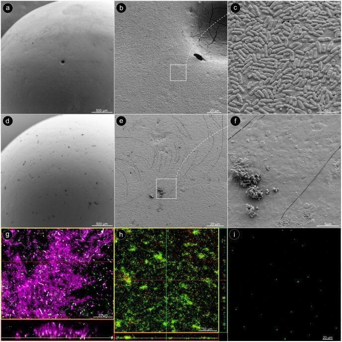 Microscopic characterization of Pseudomonas aeruginosa biofilm formation and removal on glass beads. Panels aβc show scanning electron microscopy (SEM) images of a dense, uniform biofilm monolayer before treatment. High magnification (c) reveals the characteristic rod-shaped bacterial morphology. Panels dβf illustrate the same surface after sonication; the bead appears largely cleared of biological material, with only sparse, irregular debris remaining. Panel g presents a Confocal Laser Scanning Microscopy (CLSM) image utilizing dual fluorescence: Concanavalin A (magenta) labels the extracellular sugar matrix, while Syto60 (green) identifies individual bacteria within the complex structure. Panels h and i demonstrate bacterial viability using LIVE/DEAD staining. Before sonication (h), the intact biofilm exhibits a predominant green signal, indicating a high concentration of live bacteria. After sonication (i), only isolated green fluorescence remains, confirming that while the biofilm architecture was successfully disrupted, the detached bacteria remain viable. This image series serves as an educational reference for understanding biofilm adherence, extracellular matrix composition, and the efficacy of physical detachment methods in microbiology.
