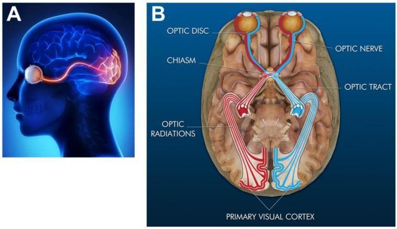 Educational anatomical diagrams illustrating the human visual system pathways across two planes. (A) Sagittal view showing the spatial arrangement of the eye sensing organ, the intracranial optic nerve pathway, and its termination at the primary visual cortex (highlighted in red) in the occipital lobe. (B) Transverse rendering providing a superior view of the visual pathway components overlaid on a brain model. Labeled structures include the eyes, optic discs, optic nerves, the X-shaped optic chiasm, optic tracts, and optic radiations (geniculocalcarine tracts). The diagram uses color-coding (red and blue) to demonstrate the partial decussation of nerve fibers at the optic chiasm, where information from each eye is distributed to both cerebral hemispheres, ultimately reaching the bilateral primary visual cortex. This visual aid is designed for teaching neuroanatomy and the physiological basis of binocular and stereoscopic vision.