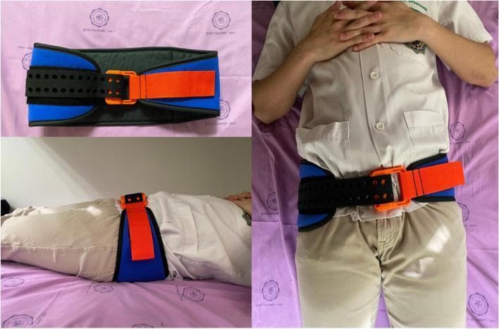 Clinical photographs demonstrating the design and application of a SAM Sling, a circumferential pelvic binder used in emergency medicine for suspected pelvic fractures. The top-left image shows the device laid flat, highlighting its components: a wide, blue padded fabric base with a black central section, a black perforated strap with precisely spaced holes for adjustable sizing, and a high-visibility orange buckle and pull-strap mechanism designed for controlled compression. The right-hand and bottom-left images show the binder applied to a patient in a supine position. The device is positioned around the greater trochanters to provide stabilization and compression to the pelvic ring. The buckle is centered anteriorly, and the strap is secured to achieve an optimal 'click' closure, indicating appropriate compressive force. This visual illustrates the correct anatomical placement (inferior to the iliac crests) and the snug, circumferential fit required for the pre-hospital or early hospital management of pelvic trauma to reduce internal pelvic volume and control hemorrhage.