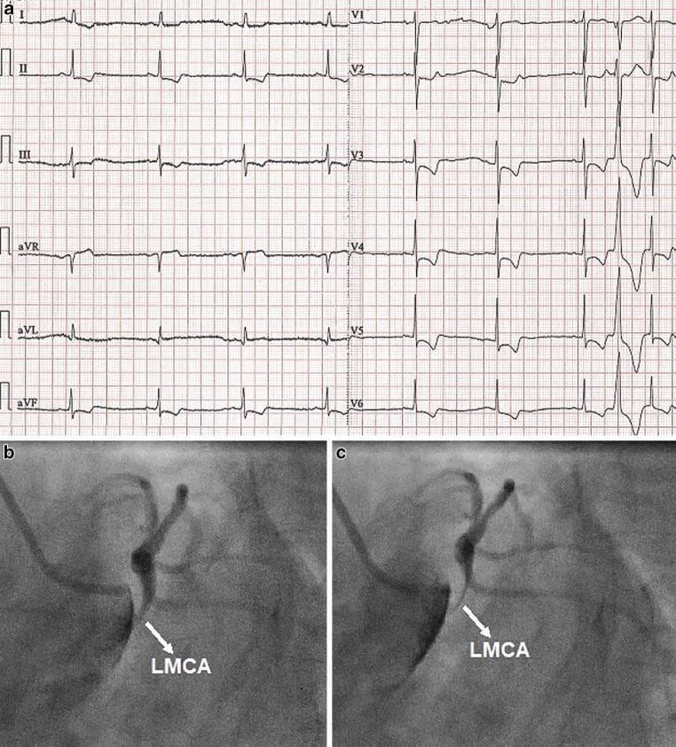 Hugging Face pmc clinical VQA raw
