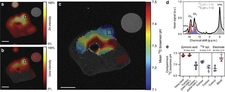 This composite educational graphic illustrates in vivo pH measurement within a MAT B III adenocarcinoma using hyperpolarized 13C Zymonic Acid (ZA). (a, b) Axial intensity maps show the accumulation of hyperpolarized ZA and 13C urea reference within the tumor mass, overlaid on grayscale anatomical proton MR images. A calibration phantom is visible in the upper right. (c) A spatial mean pH map demonstrates tumor acidity, with a color-coded biosensor pH scale ranging from 7.1 (blue, acidic) to 7.5 (red, basic). The map reveals a lower pH in the extravascular tumor compartment compared to surrounding tissue. (d) 13C NMR spectrum from a tumor voxel showing chemical shifts for ZA peaks (ZA1, ZA5) and urea, indicating two distinct pH environments (7.10 and 7.40). (e) Comparison plots validate the ZA biosensor by correlating results with 31P MRS, optical sensors, and electrode measurements across different compartments (Vena cava, intravascular, and extravascular tumor). This diagnostic imaging research demonstrates ZA's utility as a localized biosensor for assessing the acidic metabolic microenvironment of malignant tumors.