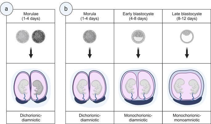 This medical illustration depicts the embryological development and placental classification of dizygotic (Panel a) and monozygotic (Panel b) twin pregnancies. Panel a shows dizygotic twins arising from two separate morulae, resulting in a dichorionic-diamniotic (DCDA) pregnancy with two distinct placentas, chorions, and amniotic sacs. Panel b illustrates the three types of monozygotic twinning based on the timing of zygote cleavage. Splitting at the morula stage (days 1-4) leads to a DCDA pregnancy. Splitting at the early blastocyst stage (days 4-8) results in a monochorionic-diamniotic (MCDA) pregnancy, characterized by a single shared chorion and placenta but two separate amniotic sacs divided by a thin membrane. Splitting at the late blastocyst stage (days 8-12) results in a monochorionic-monoamniotic (MCMA) pregnancy, where both fetuses share a single chorion, placenta, and amniotic sac without a dividing membrane. The diagram highlights the relationship between the timing of embryological division and the resulting chorionicity and amnionicity, which are critical for obstetric management and risk assessment.
