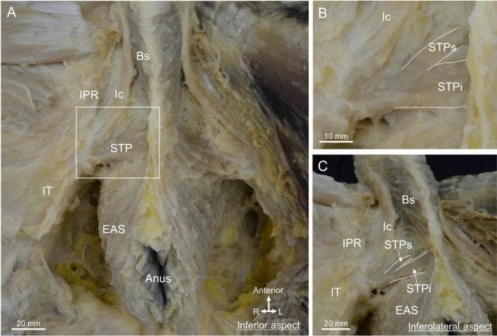 This composite of three clinical photographs displays a detailed anatomical dissection of the male perineum, focusing on the superficial perineal muscles and their spatial relationships. Panel A provides an inferior view, labeling the bulbospongiosus (Bs) centrally, the ischiocavernosus (Ic) running along the ischiopubic ramus (IPR), and the superficial transverse perineal muscle (STP) extending laterally toward the ischial tuberosity (IT). The external anal sphincter (EAS) is shown surrounding the anus. Panel B is a magnified inset of the rectangular area in A, demarcating the division of the STP into a superior bundle (STPs) and an inferior bundle (STPi). Panel C provides an inferolateral aspect with a slight pelvic tilt, illustrating the continuity between the muscle fibers of the bulbospongiosus and the external anal sphincter. The images emphasize the concentration of these muscle groups within the central region of the perineum, providing essential context for understanding pelvic floor anatomy, urogenital support, and surgical landmarks in the male pelvis.