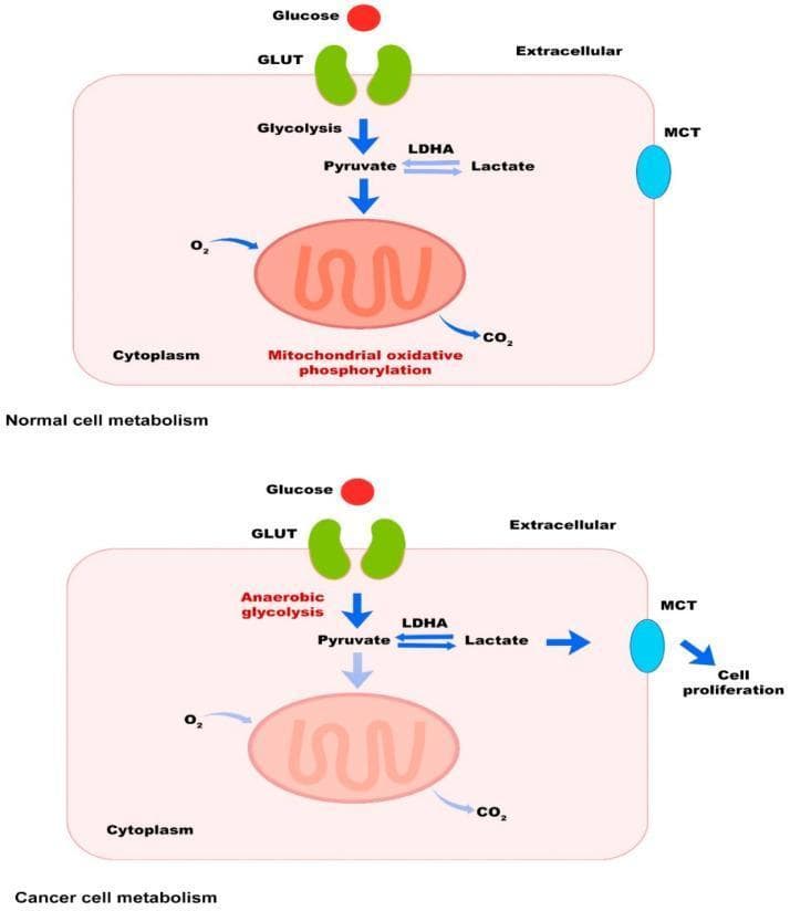 This pathophysiology diagram illustrates the metabolic differences between a normal cell and a cancer cell, specifically highlighting the Warburg effect. The top panel, 'Normal cell metabolism,' shows glucose entering the cytoplasm via GLUT transporters, undergoing glycolysis to form pyruvate, which then enters the mitochondrion for oxidative phosphorylation, consuming oxygen (O2) and releasing carbon dioxide (CO2). The bottom panel, 'Cancer cell metabolism,' depicts glucose uptake via GLUT followed by anaerobic glycolysis (even in the presence of oxygen). In this pathway, pyruvate is preferentially converted to lactate by the enzyme LDHA (lactate dehydrogenase A). The lactate is then exported from the cell through monocarboxylate transporters (MCT), a process labeled as promoting cell proliferation. This comparative diagram emphasizes the metabolic shift from efficient mitochondrial energy production in healthy tissues to rapid glycolytic processing in tumor environments, facilitating biomass accumulation and cellular growth.