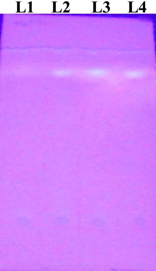 This diagnostic image shows a Thin Layer Chromatography (TLC) plate used to detect aflatoxin B1 in culture filtrates of Aspergillus flavus, a fungal pathogen associated with keratitis. The chromatogram consists of four labeled lanes (L1–L4) against a uniform purple background, likely visualized under ultraviolet (UV) light. Lane L1 contains the extract from a non-aflatoxin-producing clinical strain and shows no visible band, indicating the absence of the toxin. Lanes L2 and L3 contain extracts from an aflatoxin-producing clinical strain and an environmental strain, respectively; both display distinct fluorescent bands at a consistent retention factor (Rf). Lane L4 contains a pure aflatoxin B1 standard, which displays a band aligned with those in L2 and L3, confirming the identity of the detected metabolite. This comparison demonstrates the toxigenic potential of different A. flavus isolates, emphasizing the clinical relevance of mycotoxin production in fungal infections.