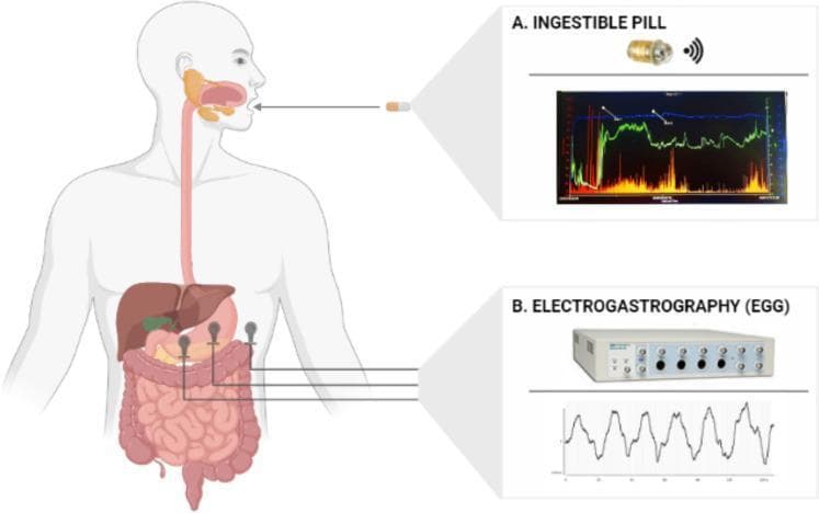This medical infographic illustrates non-invasive methods for monitoring gastrointestinal (GI) physiology. A central anatomical diagram shows the human digestive tract, including the esophagus, stomach, and intestines. Part A highlights an ingestible wireless capsule (SmartPill) being swallowed, accompanied by a MotiliGI software graph. The graph displays real-time longitudinal monitoring of intraluminal parameters across the GI tract: temperature (blue line), pH levels (green line), and pressure (orange bars). Part B illustrates surface electrogastrography (EGG) setup. It depicts a 1-channel bipolar electrode montage with three cutaneous electrodes placed on the abdominal wall over the stomach region. This is connected to a data acquisition device (PowerLab) that records gastric myoelectric activity. Below the device, a typical EGG waveform shows rhythmic electrical oscillations corresponding to the stomach's slow-wave activity (approximately 0.05 Hz). These tools are used in clinical gastroenterology to evaluate gastric emptying, intestinal transit times, and myoelectric motility disorders such as gastroparesis.