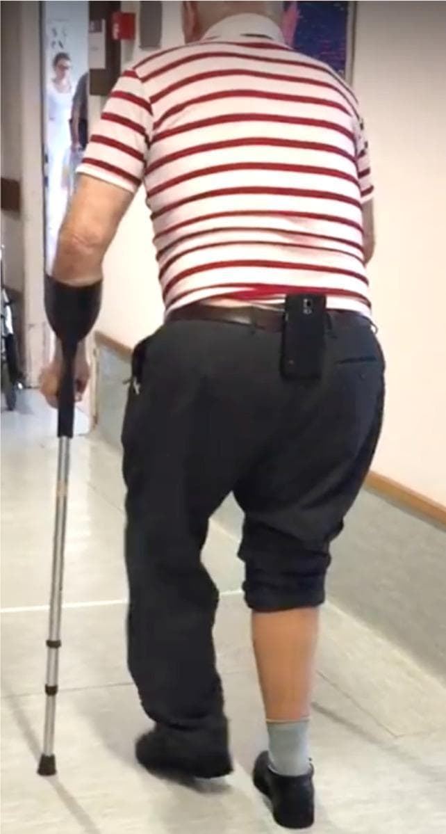 A clinical photograph depicting a participant in a rehabilitation research setting, viewed from behind. The individual is performing a functional mobility assessment, likely a Six-Minute Walk Test (6MWT). The participant utilizes a forearm crutch (Lofstrand crutch) in the left hand for gait stabilization. An Android smartphone is mounted vertically to the center of the participant's belt at the lower back (L5/sacral region), serving as a wearable inertial measurement unit (IMU) to collect tri-axial accelerometer and gyroscope data. The participant's lower extremities show asymmetry: the left leg is fully clothed in dark trousers, while the right trouser leg is absent, revealing a grey sock and black shoe on the right foot. This setup is characteristic of gait analysis studies focused on automated step-detection, spatiotemporal gait parameters, and the integration of mobile health (mHealth) technology in physical therapy and geriatric rehabilitation.