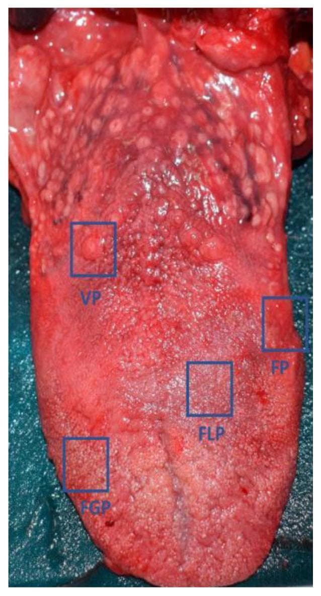 A clinical photograph of a human cadaver tongue, providing a macroscopic view of the dorsal and lateral surfaces to demonstrate the distribution of lingual papillae. The image features blue bounding boxes and labels identifying the four primary types of papillae: Circumvallate papillae (VP), shown as large, circular, dome-shaped structures arranged in a V-shaped row at the posterior aspect of the tongue; Foliate papillae (FP), located as vertical folds or ridges along the posterolateral margins; Fungiform papillae (FGP), visible as small, reddish, mushroom-shaped dots scattered primarily across the anterior two-thirds and tip; and Filiform papillae (FLP), which are the most numerous, giving the tongue its characteristic rough, grayish-pink texture. The specimen displays a natural reddish-pink color with no obvious gross pathological lesions or significant structural alterations. This image is intended for anatomical education and as a baseline for clinical comparison in studies involving gustatory changes or inflammatory conditions affecting the oral mucosa.