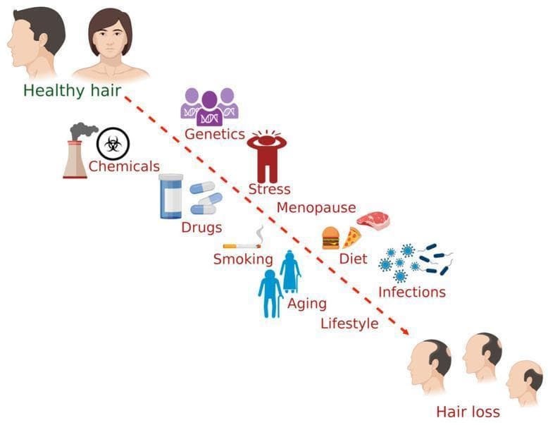 This medical infographic illustrates the multifactorial etiology of hair loss in humans, depicting a progression from 'Healthy hair' to 'Hair loss.' The diagram utilizes a descending dashed red arrow to represent the transition between these two clinical states. Positioned along this pathway are various internal and external contributing factors, each represented by a descriptive icon and text label. These factors include: Chemicals (environmental/occupational exposure), Genetics (hereditary predisposition), Drugs (pharmacological side effects), Stress (psychosocial impact), Smoking, Menopause (hormonal changes), Aging (senescence), Diet (nutritional status/lifestyle), and Infections (pathogenic microorganisms). The top-left corner features healthy male and female profiles with full scalp coverage, while the bottom-right corner displays three male profiles exhibiting progressive stages of androgenetic alopecia-like patterns, including bitemporal recession and vertex thinning. This visual aid is designed for medical education to summarize the complex interactions between lifestyle, environmental, and biological factors that influence follicular health and the progression of alopecia.