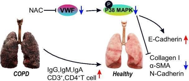 A pathophysiology diagram illustrating the molecular mechanism by which N-acetylcysteine (NAC) improves Chronic Obstructive Pulmonary Disease (COPD)-induced pulmonary fibrosis. The visual contrasts a pathological COPD lung—exhibiting a dark, shriveled, and fibrotic appearance—with a smooth, pink, and healthy-appearing lung. The central mechanism shows NAC inhibiting the expression of Von Willebrand Factor (VWF), which leads to a downstream reduction in p38 mitogen-activated protein kinase (MAPK) phosphorylation. This inhibitory pathway results in an upregulated immune response, characterized by increased levels of IgG, IgM, IgA, and CD3+/CD4+ T cells. Simultaneously, the suppression of the VWF/p38 MAPK axis promotes E-Cadherin expression while inhibiting markers of epithelial-mesenchymal transition (EMT) and fibrosis, specifically decreasing Collagen I, alpha-smooth muscle actin (α-SMA), and N-Cadherin. The diagram provides a comprehensive overview of how antioxidant therapy may modulate the VWF/p38 MAPK/EMT axis to restore pulmonary function and immune homeostasis in chronic respiratory pathology.