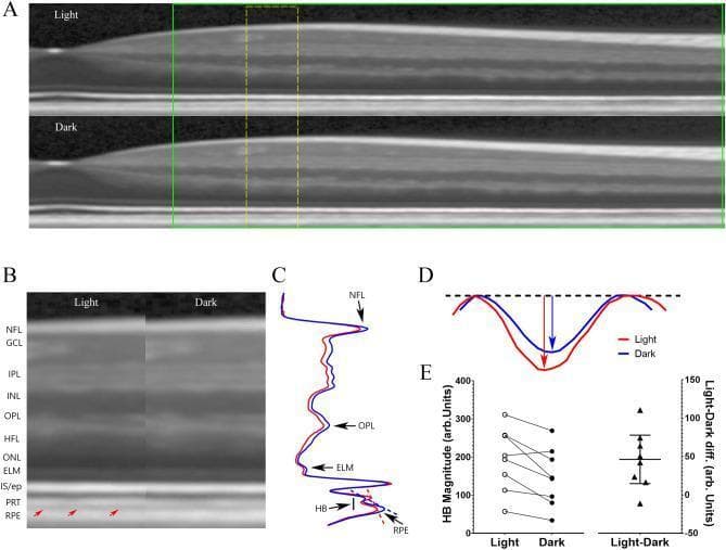 This composite educational graphic illustrates the functional assessment of the human outer retina using Optical Coherence Tomography (OCT) under light and dark adaptation conditions. (A) B-scans of a human eye flattened along the Retinal Pigment Epithelium (RPE) demonstrate structural layering. (B) Magnified side-by-side comparison reveals a hyperreflective band (HB) between the photoreceptor tip layer (PRT) and the RPE, prominently marked by red arrows in the light-adapted state. (C) Transretinal intensity profiles map layers including the Nerve Fiber Layer (NFL), Outer Plexiform Layer (OPL), and External Limiting Membrane (ELM), with the HB region quantified against a dashed baseline connecting PRT and RPE peaks. (D) A magnified intensity plot highlights the higher HB magnitude in light (red line) versus dark (blue line). (E) Quantitative data from eight subjects show a consistent significant reduction in HB magnitude during dark adaptation. This content demonstrates how OCT biomarkers can be used to evaluate physiological and metabolic changes at the rod-RPE interface, providing insights into mitochondrial function in the outer retina.