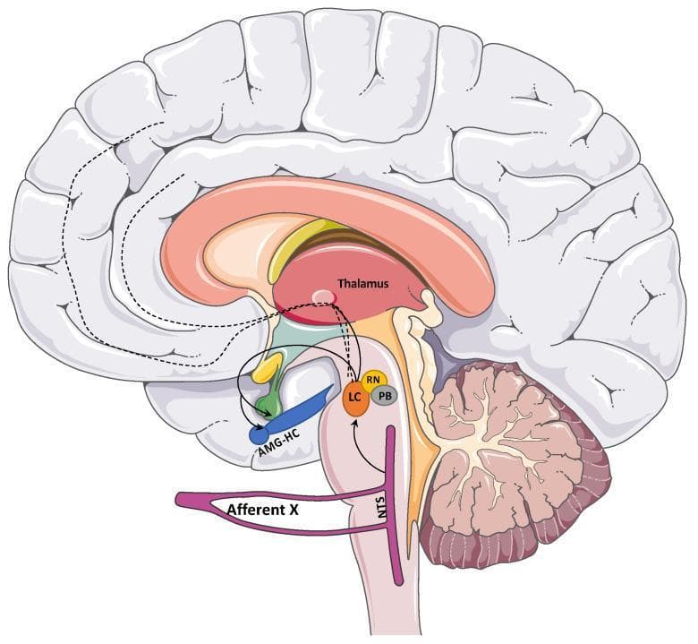 This medical anatomical diagram illustrates the central afferent pathways of the vagus nerve (Cranial Nerve X) within a sagittal section of the human brain. The pathway begins with the 'Afferent X' projecting to the Nucleus Tractus Solitarius (NTS) in the medulla. From the NTS, the diagram maps secondary projections to brainstem nuclei including the Locus Coeruleus (LC), Raphe Nuclei (RN), and Parabrachial Nucleus (PB). Further rostral connections are shown extending to limbic structures, specifically the Amygdala-Hippocampus complex (AMG-HC), and the Thalamus. Dotted lines indicate tertiary projections from the Thalamus and LC toward the cerebral cortex, representing the neuroanatomical basis for Vagus Nerve Stimulation (VNS) effects on cortical excitability and mood regulation. This schematic is designed for educational use in neurology and neurosurgery to demonstrate the integration of visceral sensory information into higher-order brain centers.