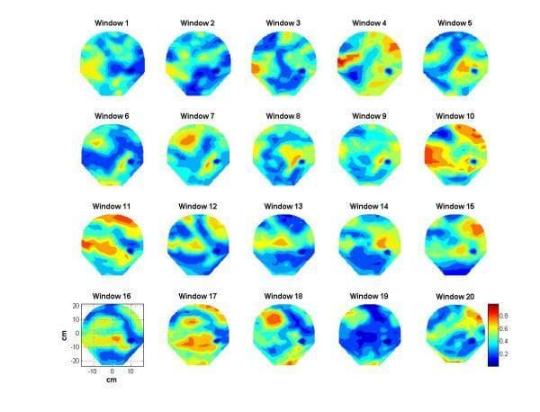 This figure presents a series of twenty sequential contour plots mapping phase synchronization indices derived from transabdominal magnetomyography (MMG) data. Each plot, labeled 'Window 1' through 'Window 20', represents a 20-second stepping interval of uterine activity in a pregnant subject. The spatial maps utilize a color scale ranging from blue (0.0, low synchronization/quiescence) to red (1.0, high synchronization/peak contraction). Centimeters (cm) on the axes in Window 16 indicate the spatial distribution over the maternal abdomen. The series illustrates the spatio-temporal evolution of uterine electrical activity, where windows 10, 11, and 17 show significant clusters of orange and red, indicating localized regions of high synchronization characteristic of uterine contractions. Other windows, such as 6 and 19, are dominated by blue and green shades, representing baseline relaxation phases. This visualization is used in reproductive assessment to study the emergence of coordinated electrical activity in the myometrium, which is critical for identifying labor progression and distinguishing between Braxton-Hicks and true labor contractions.
